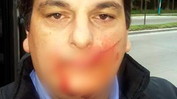 Colectivero de la línea 203 agredido con un machete (imagen censurada) Colectivero de la línea 203 agredido con un machete (imagen censurada)