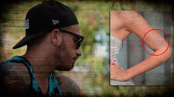 hablo fede bal: el causante del moreton de barbie pude haber sido yo hablo fede bal: el causante del moreton de barbie pude haber sido yo