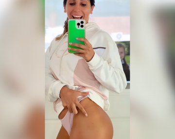 Pulgas voraces atacaron la cola de Cinthia Fernández