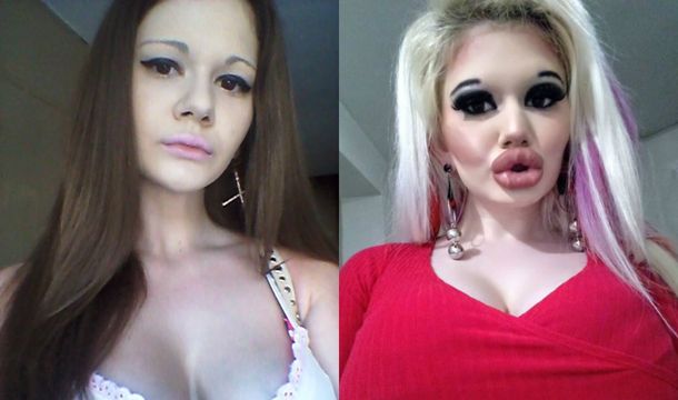 Andrea está feliz con su apariencia y la atención que obtiene