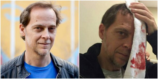 Matías Martin tuvo un accidente domético.