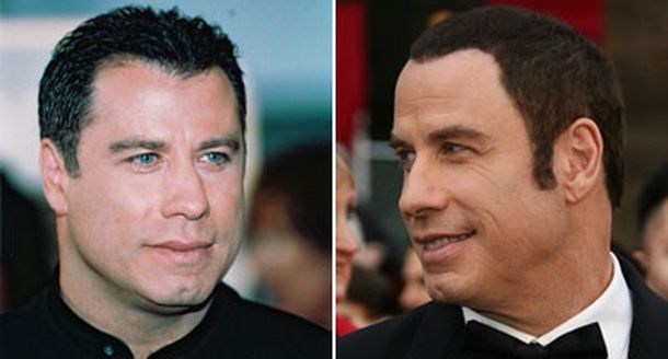 Travolta-antes-y-despues