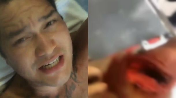 Lo atacó un tiburón y compartió las imágenes de la herida en Instagram