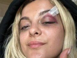 Agredieron a la cantante Bebe Rexha en medio de un recital