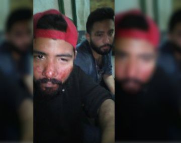 Ariel y Matías fueron agredidos brutalmente cerca de la estación de trenes de Quilmes