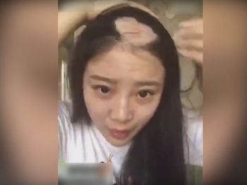 Se arrancó el pelo haciendo un desafío viral