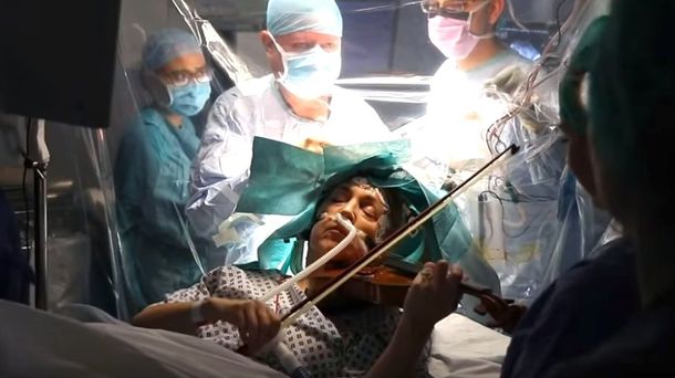 Impresionante video: una mujer toca el violín mientras le extirpan un tumor del cerebro