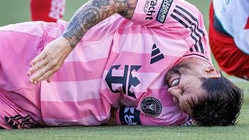 Lionel Messi lesionado. Lionel Messi lesionado.