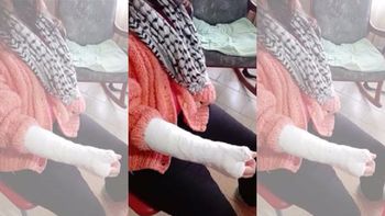 La obligaron a comer pasto y le fracturaron los dedos La obligaron a comer pasto y le fracturaron los dedos