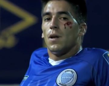 El sangriento codazo que el árbitro decidió ignorar