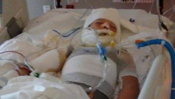 El pequeño sufrió un grave caso de bullying. El pequeño sufrió un grave caso de bullying.