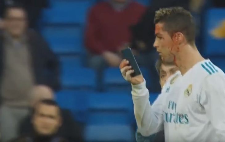 Cristiano Ronaldo se cortó la cara y pidió mirarse con un celular