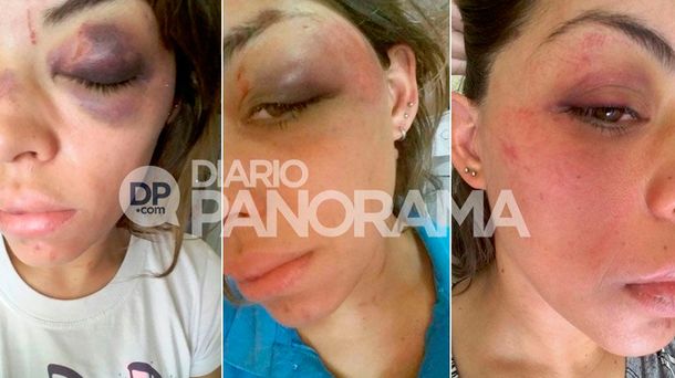 Florencia González de 28 años fue salvajemente golpeada por su ex pareja.