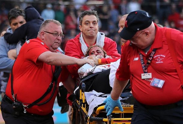 VIDEO: Un batazo le rompió la cara a una espectadora en pleno partido