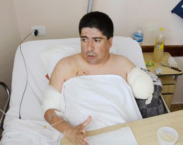 Su perro le arrancó un brazo y lo defiende