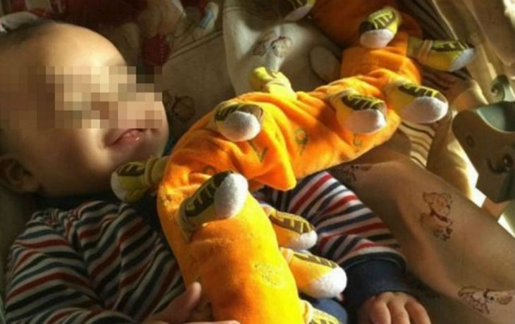 Valentino, el bebe de ocho meses internado