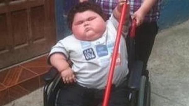 Un nene de cinco años pesa 116 kilos y está internado en un hospital de Santa Fe
