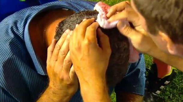 Gustavo Alfaro recibió un proyectil en el Gigante de Arroyito