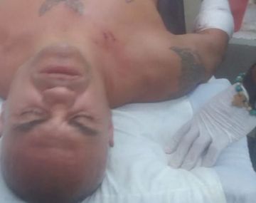 El boxeador habría sido víctima de un robo