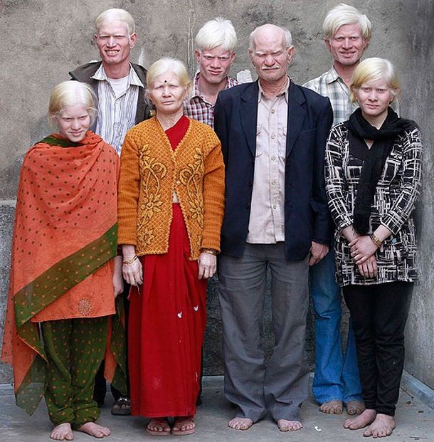 Albino clan