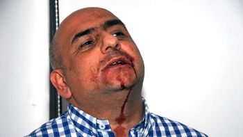 #diadefuria: de narvaez, denunciado por pegarle a un periodista en la plata #diadefuria: de narvaez, denunciado por pegarle a un periodista en la plata