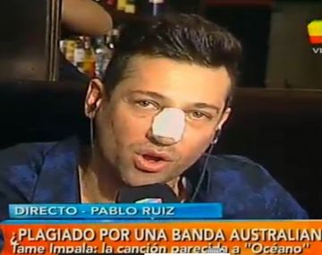 Pablito Ruíz reapareció tras su múltiple cirugía estética