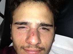 brutal golpiza a un joven por ser homosexual en san isidro brutal golpiza a un joven por ser homosexual en san isidro