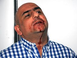 #diadefuria: de narvaez, denunciado por pegarle a un periodista en la plata #diadefuria: de narvaez, denunciado por pegarle a un periodista en la plata