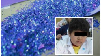 nene que aspiro purpurina, con muerte cerebral nene que aspiro purpurina, con muerte cerebral