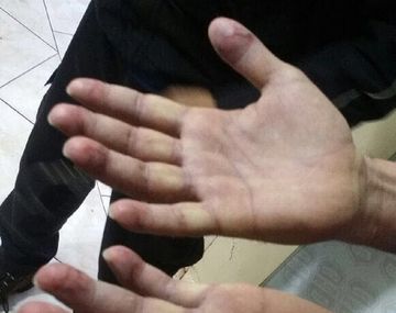 Ibar Pérez Corradi pagó 50 mil dólares para borrar sus huellas dactilares