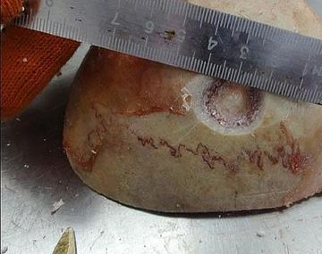 Cirugías cerebrales hace 2.300 años