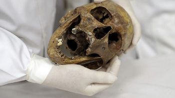 Usan los restos del nazi Mengele para estudiar medicina - Crédito: AP Usan los restos del nazi Mengele para estudiar medicina - Crédito: AP