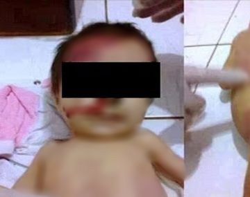 Macabro: golpearon  a su hija de 3 meses hasta dejarla inconsciente