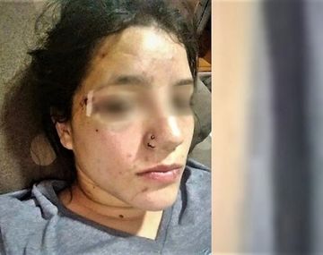 Fue a bailar en Año Nuevo y le dieron una brutal paliza