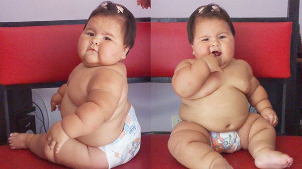 Inician campaña para ayudar a una beba que padece obesidad mórbida