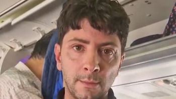 adrian salonia conto como fue deportado de venezuela sin explicaciones: retuvieron nuestros pasaportes adrian salonia conto como fue deportado de venezuela sin explicaciones: retuvieron nuestros pasaportes