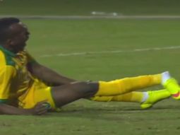 mira esta impresionante fractura expuesta mira esta impresionante fractura expuesta