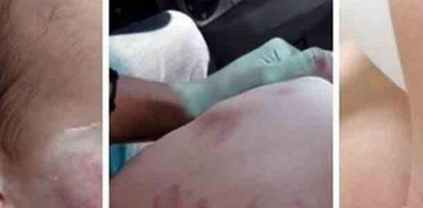 Las heridas que subrió el bebé