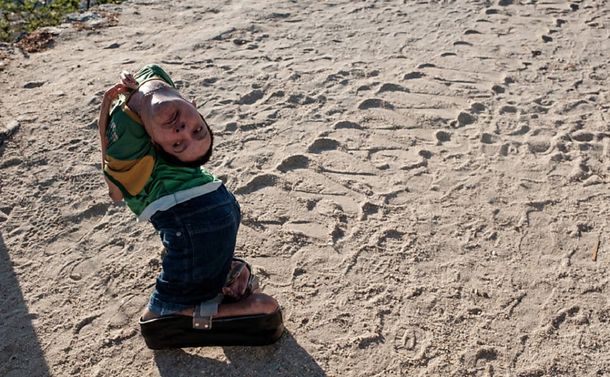 El hombre que nació con la cabeza al revés publicó un libro