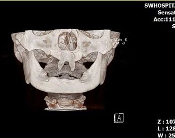 Un joven chino sorprende con sus colmillos de vampiro