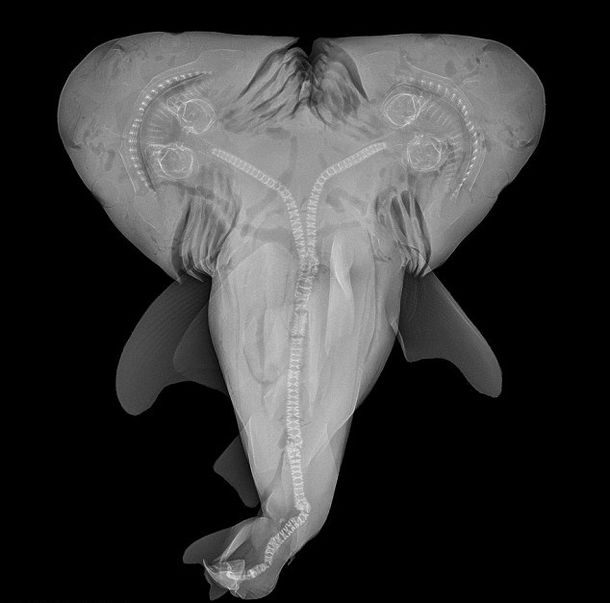 La radiografía del feto de tiburón bicéfalo