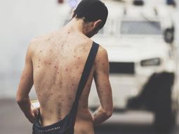 Manifestante desnudo en una autopista de Caracas se viralizó Manifestante desnudo en una autopista de Caracas se viralizó