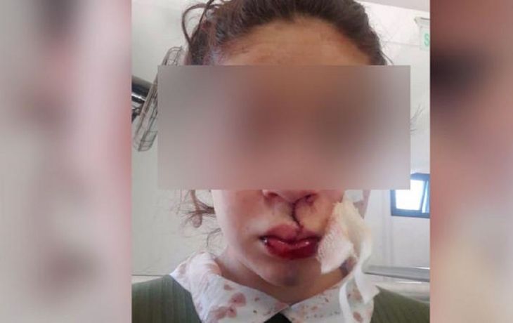 Otro caso de violencia en un control policial: la golpearon hasta sacarle los dientes