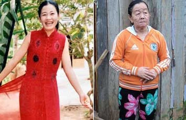 Antes-y-despúes