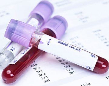 Un test de sangre permite la detección temprana de 50 tipos de cáncer