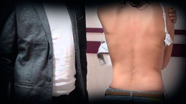 Por atrevido: quiso desprenderle el corpiño en un bar y ella lo molió a golpes