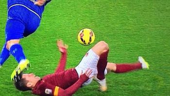 impactante lesion de iturbe en el empate de la roma impactante lesion de iturbe en el empate de la roma