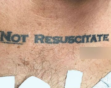 Lo internaron de urgencia y tenía tatuada la fraseNo resucitar