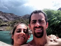 Carla sufrió la extirpación parcial de uno de sus intestinos. Carla sufrió la extirpación parcial de uno de sus intestinos.