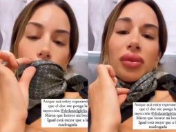 ¿Qué le pasó a Estefi Berardi? La preocupación de sus seguidores tras ver su reacción alérgica
